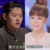 Thẩm mỹ viện - Hô biến răng vẩu, mắt hí nhờ dao kéo