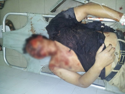 Trộm gỗ, bị dân vây đánh tới biến dạng cơ thể - 2