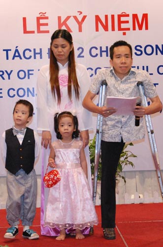 Kỷ niệm 25 năm phẫu thuật cặp song sinh dính liền Việt-Đức - 1