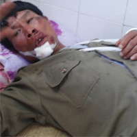 Pháp luật - "Cẩu tặc" múa kiếm tấn công cảnh sát