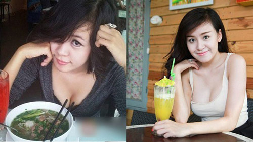 Hot girl Việt hậu phẫu thuật thẩm mỹ - 4