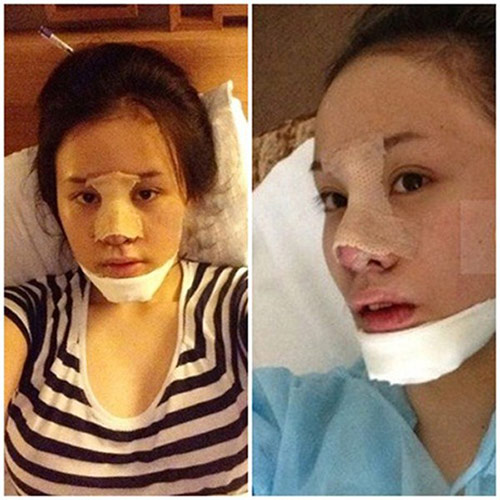 Hot girl Việt hậu phẫu thuật thẩm mỹ - 5