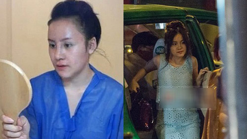 Hot girl Việt hậu phẫu thuật thẩm mỹ - 6