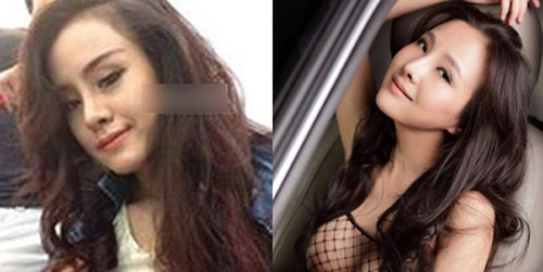 Hot girl Việt hậu phẫu thuật thẩm mỹ - 7