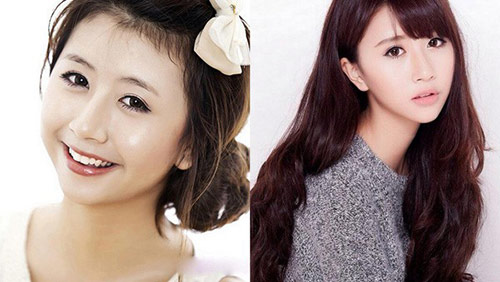 Hot girl Việt hậu phẫu thuật thẩm mỹ - 8