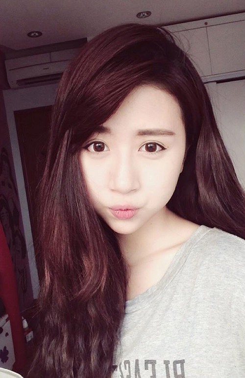 Hot girl Việt hậu phẫu thuật thẩm mỹ - 9