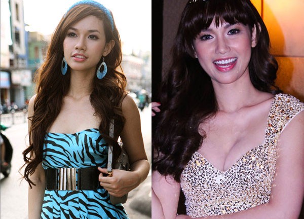 Hot girl Việt hậu phẫu thuật thẩm mỹ - 6