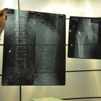 Sức khỏe đời sống - Hai năm, bác sĩ “ăn” hơn 18.000 tấm phim