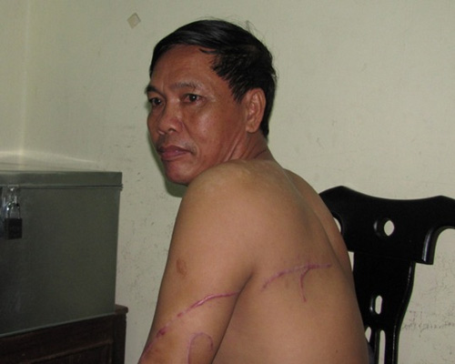 chem thue ma tau chem nguoi dam thue chem muon co y gay thuong tich mau thuan thue con do chem nguoi thue giang ho chem nguoi cong an bao cong an bao cong an bao an ninh an ninh tin an ninh phap luat tin phap luat bao phap luat tin nhanh tin moi tin hay tin nong tin hot tin tức tin tuc tintuc tin tuc online bao dien tu bao vn xa hoi doc bao bao viet nam vn