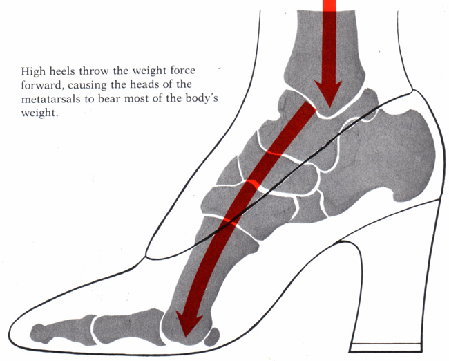 Hiểm họa bệnh tật ẩn chứa từ thời trang - 9
