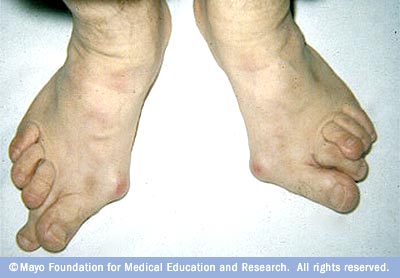 Hiểm họa bệnh tật ẩn chứa từ thời trang - 10