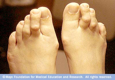 Hiểm họa bệnh tật ẩn chứa từ thời trang - 11