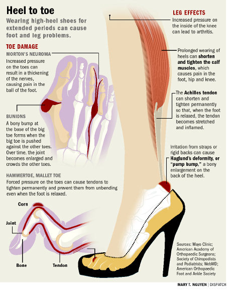 Hiểm họa bệnh tật ẩn chứa từ thời trang - 8