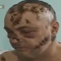 Tin tức trong ngày - Ma túy "ăn thịt người" xâm nhập nước Mỹ