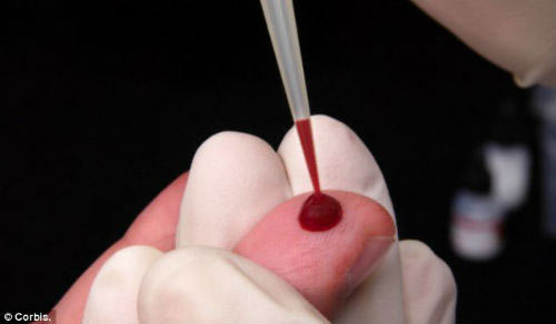 Virut mới nguy hiểm hơn HIV đang lây lan nhanh chóng - 2