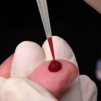 Sức khỏe đời sống - Virut mới nguy hiểm hơn HIV đang lây lan nhanh chóng