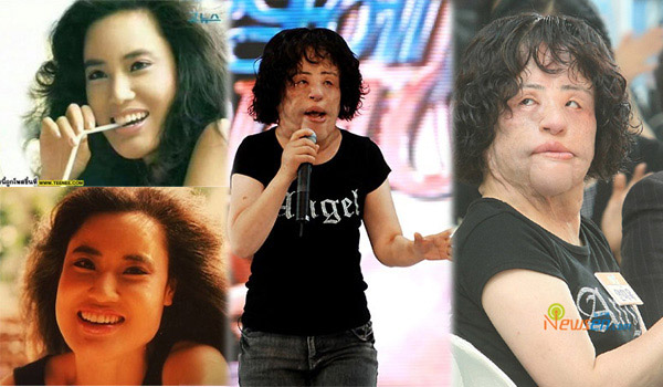 Sao tự "dìm" mình vì thẩm mỹ - 1