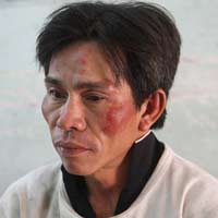 Pháp luật - Đặc nhiệm bắt cướp trên đường áp giải hai kẻ trộm