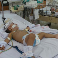 Sức khỏe đời sống - Hóc xương cá, bé gái nguy kịch