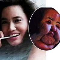 Thẩm mỹ viện - 10 chiếc mũi vẹo vọ vì thẩm mỹ
