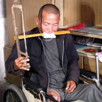 Sức khỏe đời sống - Những ca tự phẫu thuật rùng rợn nhất