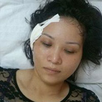 Pháp luật - Súng công an xã cướp cò làm cô gái bị thương