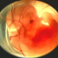 Sức khỏe đời sống - Nhau thai không thể là thuốc