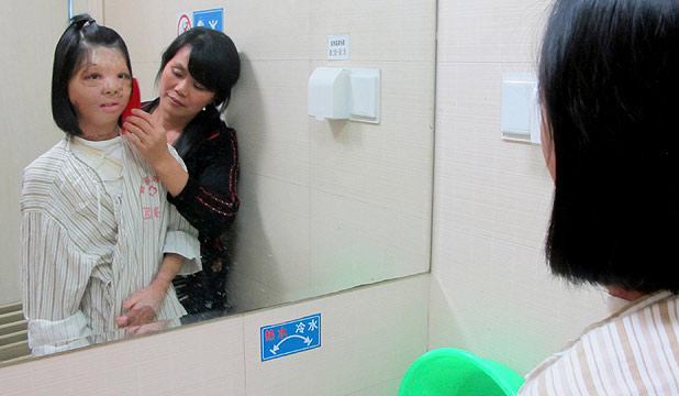 Trung Quốc: Cô gái nuôi khuôn mặt ở trên ngực - 2