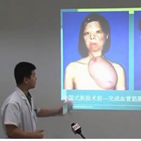 Tin tức trong ngày - Trung Quốc: Cô gái nuôi khuôn mặt ở trên ngực