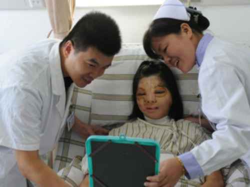 Ghép khuôn mặt được nuôi trên ngực thiếu nữ - 5