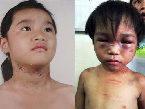 Be trai bi tra tan da man danh chau 3 tuoi bao hanh tre em tra tan da man hanh ha tre em danh dap tre em danh tre em chich thuoc la cau danh chau tre bi nguoi than danh dap cong an bao cong an bao cong an bao an ninh an ninh tin an ninh phap luat tin phap luat bao phap luat tin nhanh tin moi tin hay tin nong tin hot tin tức tin tuc tintuc tin tuc online bao dien tu bao vn xa hoi doc bao bao viet nam vn