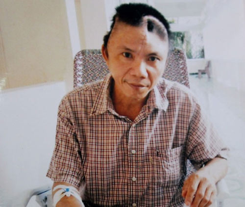Đằng sau vụ sàm sỡ thím, đánh chú vỡ hộp sọ - 1