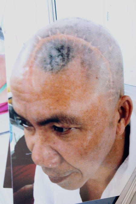Đằng sau vụ sàm sỡ thím, đánh chú vỡ hộp sọ - 2