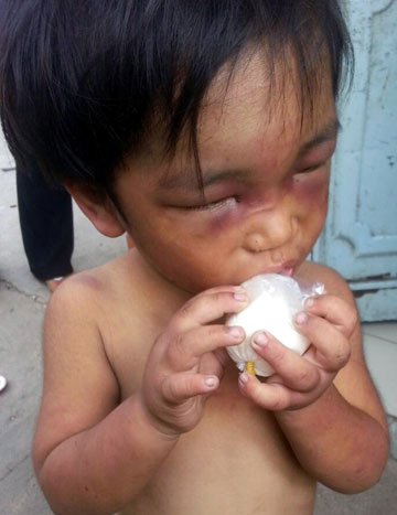 Bé trai bị tra tấn: Hành vi tàn ác của người cậu - 1