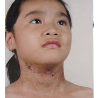 Pháp luật - Điều tra vụ bố ruột, mẹ kế đánh con gãy xương