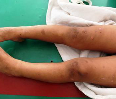 Bé trai bị cậu ruột tra tấn: Tấn bi kịch truyền kiếp - 2