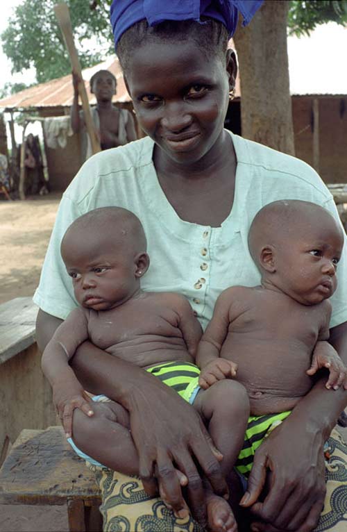 Huyền thoại “làng song sinh” ở Nigeria - 2