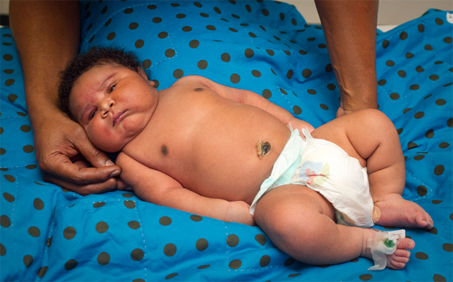JaMichael Brown được mệnh danh là em bé khổng lồ nhất tại Texas với cân nặng 7,28kg. Em được sinh ra tại bệnh viện Good Michael Shepherd tháng 7/2011
