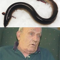 Phi thường - kỳ quặc - 5 người bị sinh vật "sống" trong cơ thể