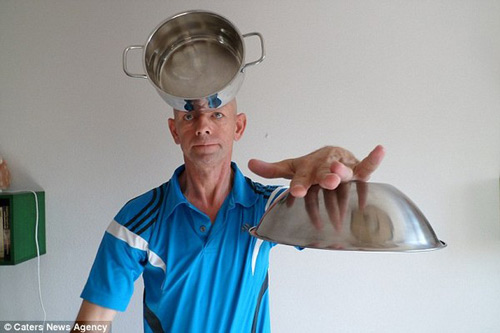 Kỳ lạ với những "người nam châm" - 2