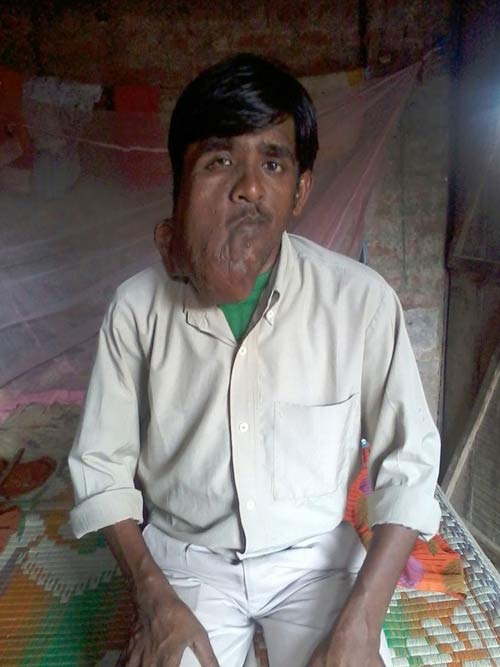 Chàng trai người Ấn có biệt danh "người voi" - 4