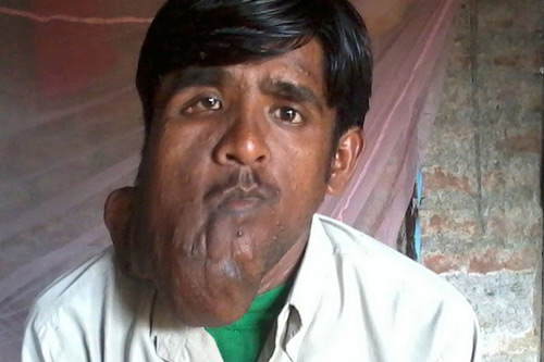 Chàng trai người Ấn có biệt danh "người voi" - 5