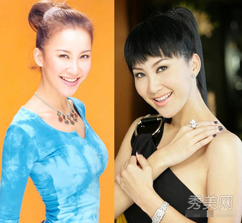 Sao giải trí đẹp hơn nhờ sửa mắt 2 mí - 9