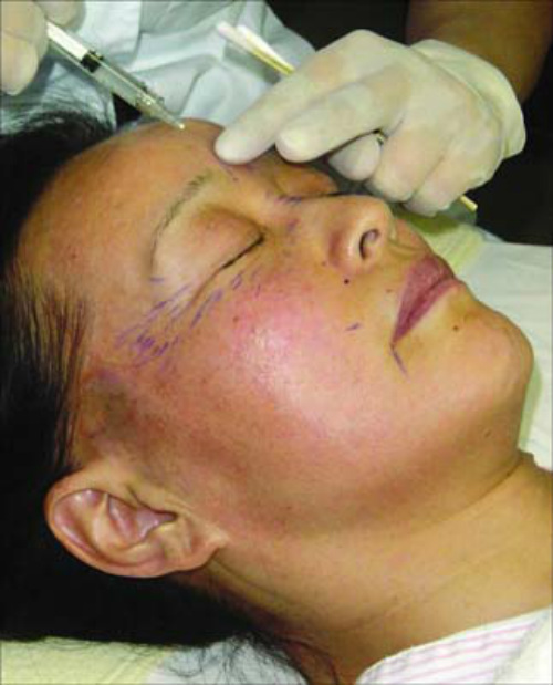 Lưu Hiểu Khánh thừa nhận dùng Photoshop - 4