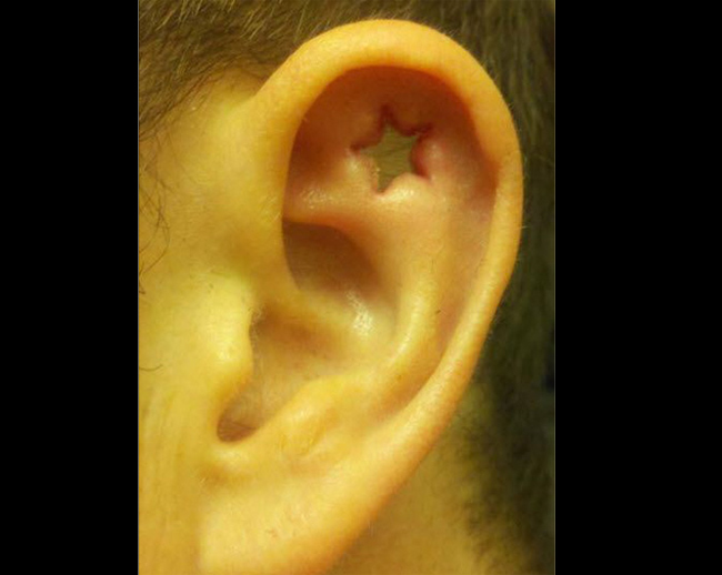 Ngoài phần dái tai, nhiều dân chơi cá tính cũng chịu đau khi khoét hình ngôi sao ở mép trên gần vành tai.
