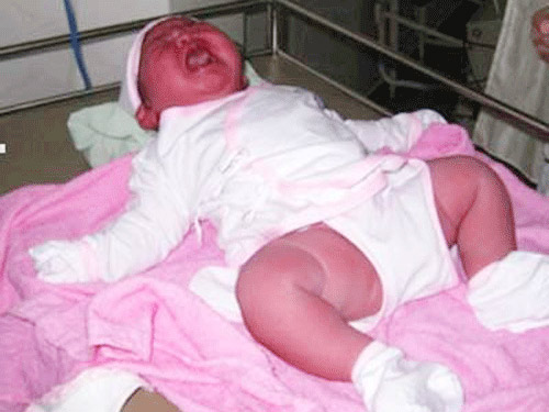 Sản phụ sinh bé gái nặng 6kg ở Bình Thuận - 1