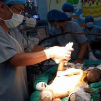 Sức khỏe đời sống - Điều chưa biết trong ca mổ tách 2 bé dính liền