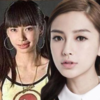 Ngôi sao điện ảnh - Sao "đổi đời" nhờ phẫu thuật thẩm mỹ