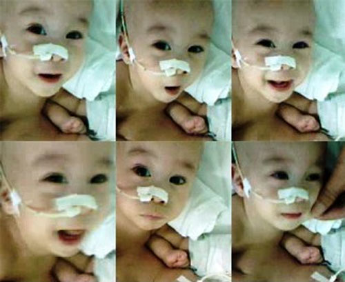 2 bé dính tim: Sinh con 11 tháng, bế con được 1 giờ - 2