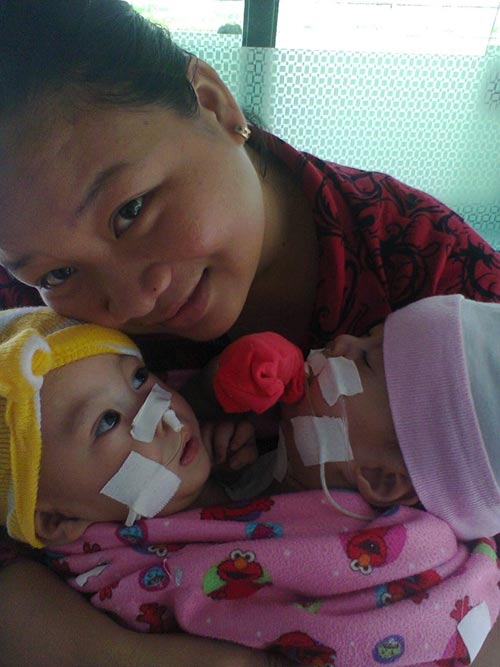 2 bé dính tim: Sinh con 11 tháng, bế con được 1 giờ - 3